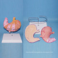 Human Normal Stomach Anatomy Gastric Ulcer Teaching Model (R100204)